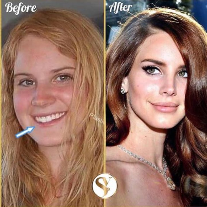 lana del rey before and after
